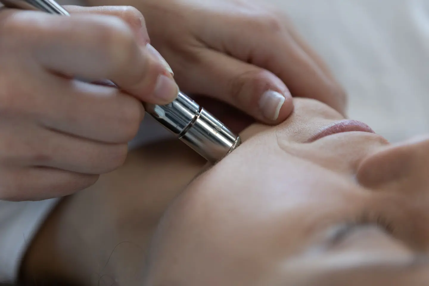 Pristine-treatment-min