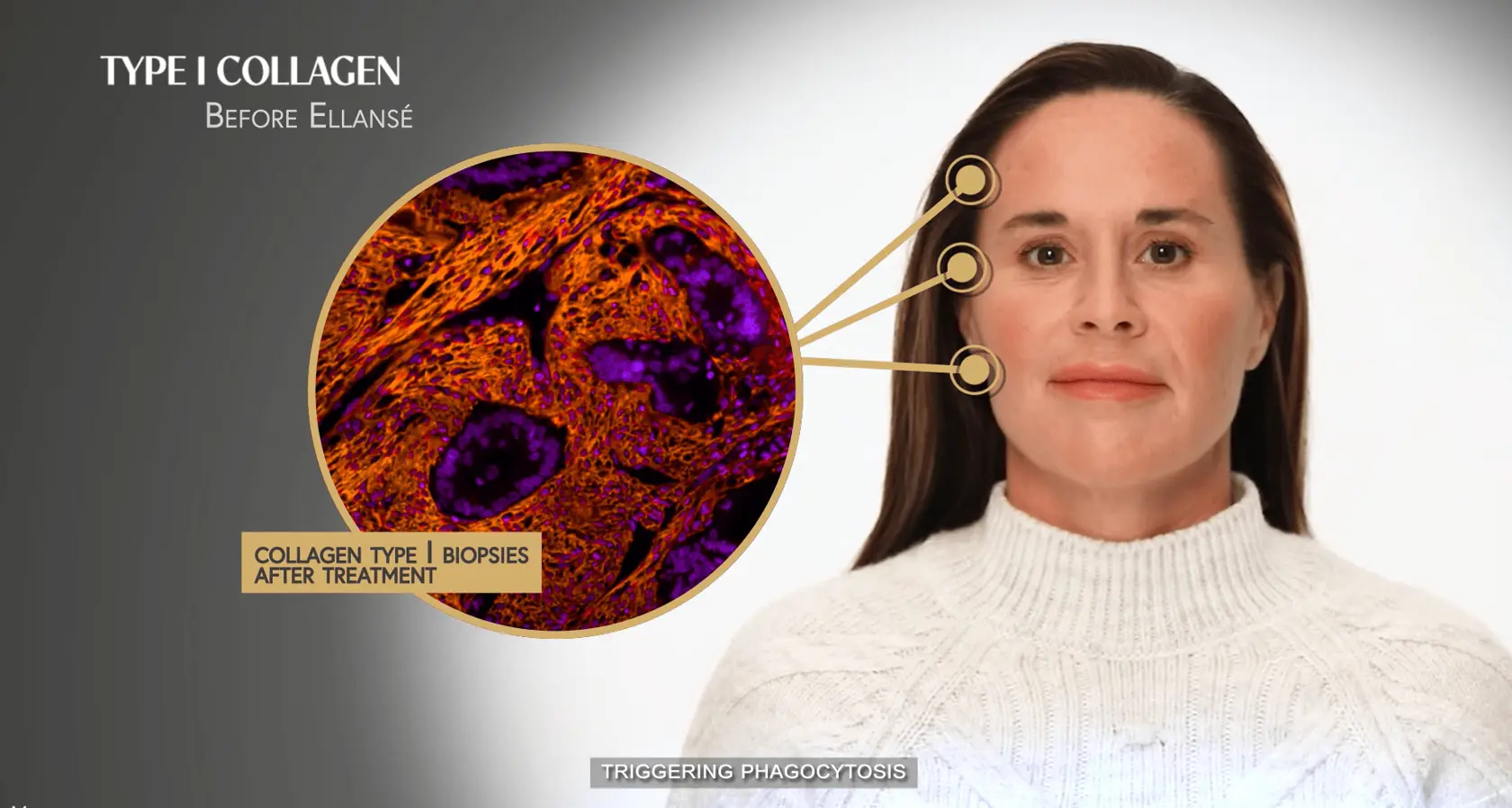 Type 1 Collagen Ellanse Best Collagen Min