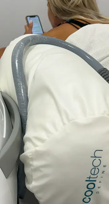Cooltech Define Cryolipolysis Device - Sinclair Global