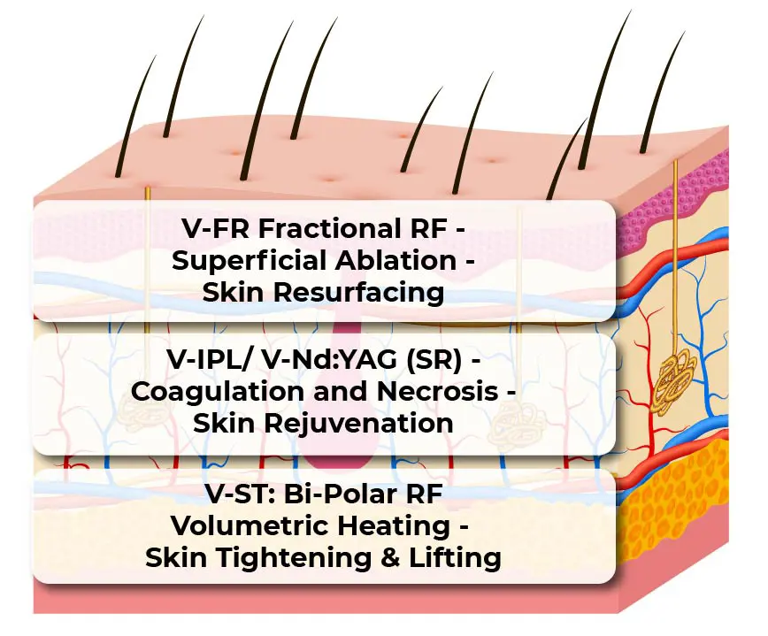 Figure 5 01