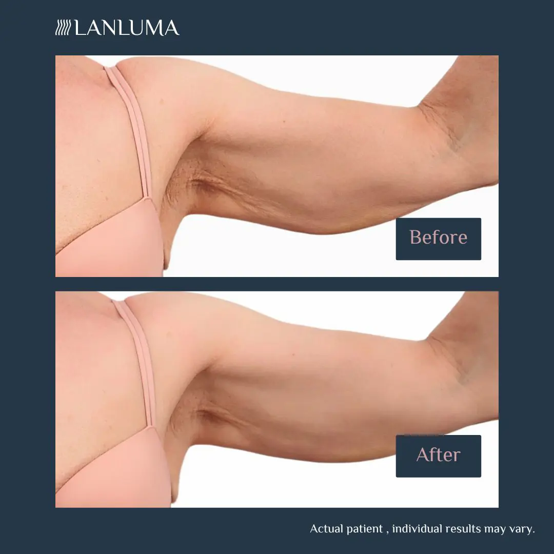 Brunette Centre Left 1